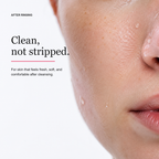 Snowkiss Cloud-Foam Cleanser | Gentle Facial Cleanser