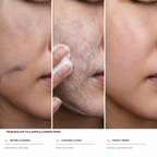 Snowkiss Cloud-Foam Cleanser | Gentle Facial Cleanser
